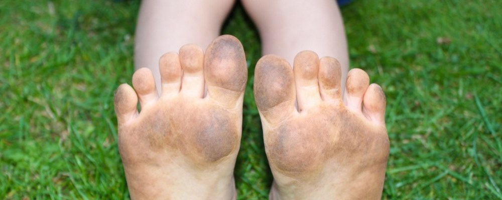 dirty feet